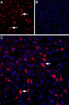 Anti-GRIK4 (KA1) (extracellular) Antibody