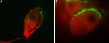 Anti-Vesicular GABA Transporter (VGAT) Antibody