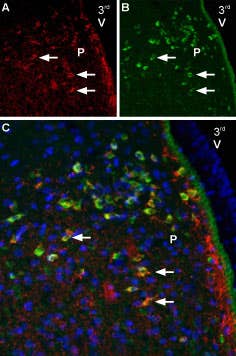 Anti-Melatonin Receptor 1B (MTNR1B) Antibody