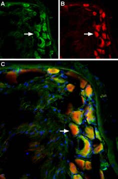Guinea pig Anti-TRPV2 (VRL1) (extracellular) Antibody