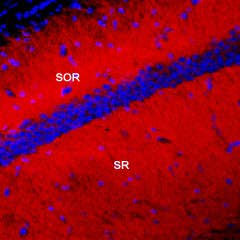 Guinea pig Anti-K<sub>V</sub>4.2 Antibody