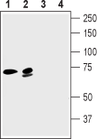 Guinea pig Anti-KCNN2 (K<sub>Ca</sub>2.2, SK2) Antibody