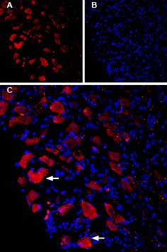 Guinea pig Anti-Ca<sub>V</sub>1.3 (CACNA1D) Antibody