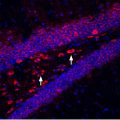 Guinea pig Anti-K<sub>ir</sub>6.2 Antibody