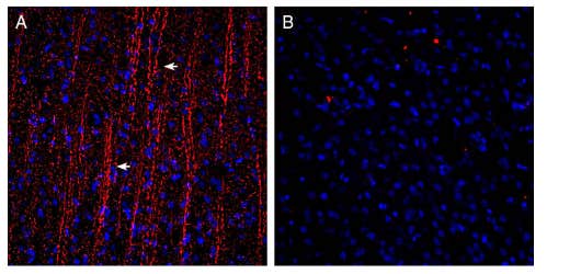 Guinea pig Anti-P2Y12 Receptor (extracellular) Antibody