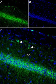 Guinea pig Anti-K<sub>V</sub>2.1 Antibody