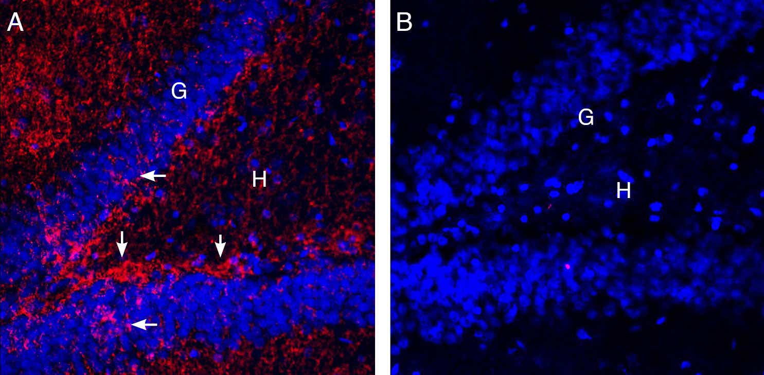 Guinea Pig Anti-EAAT2 (GLT-1) (extracellular) Antibody