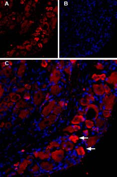 Guinea pig Anti-TRPV1 (VR1) Antibody