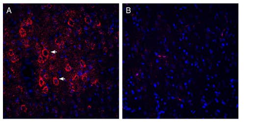 Guinea Pig Anti-VGLUT2 Antibody