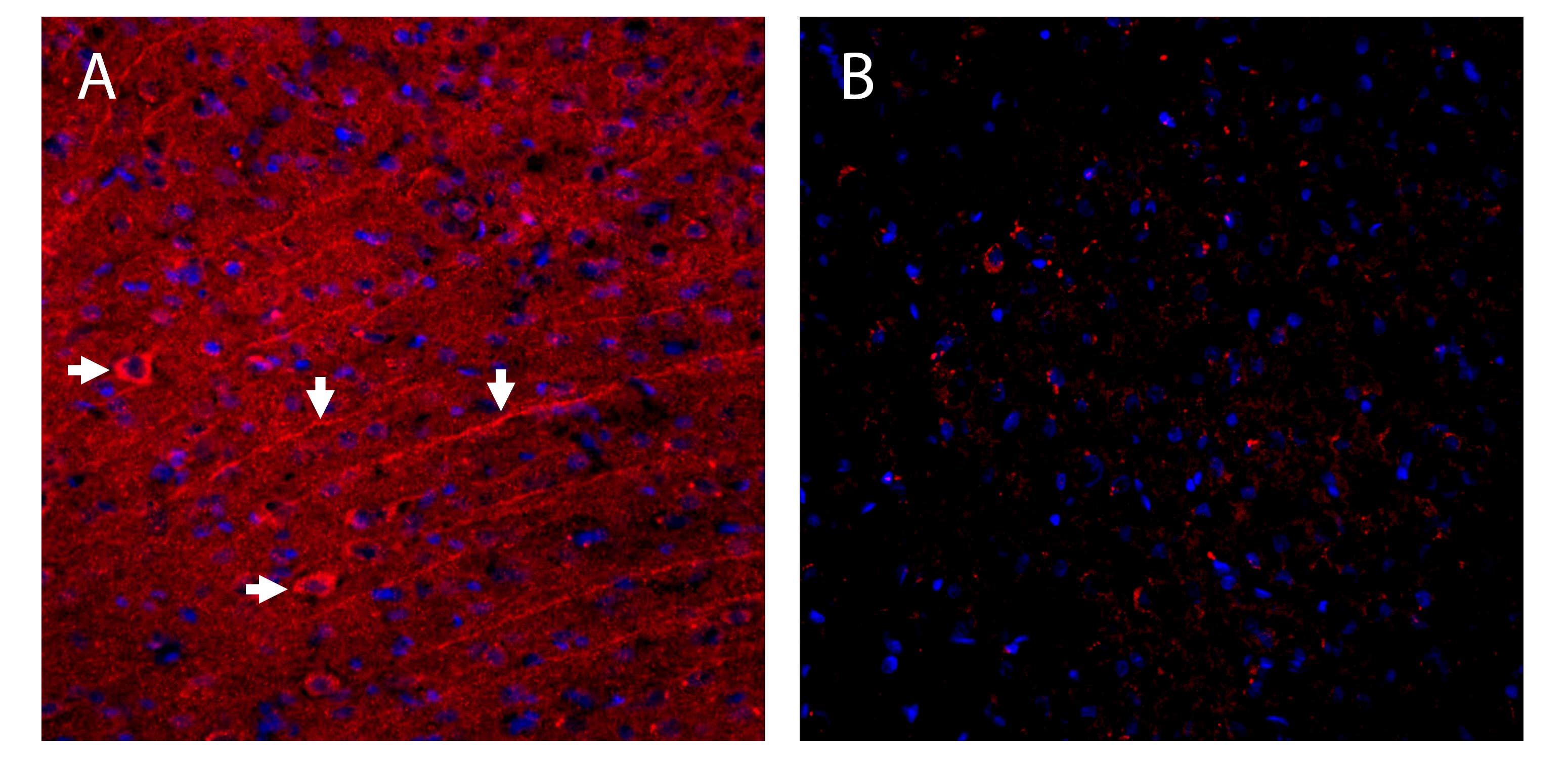 Guinea Pig Anti-SynGAP Antibody