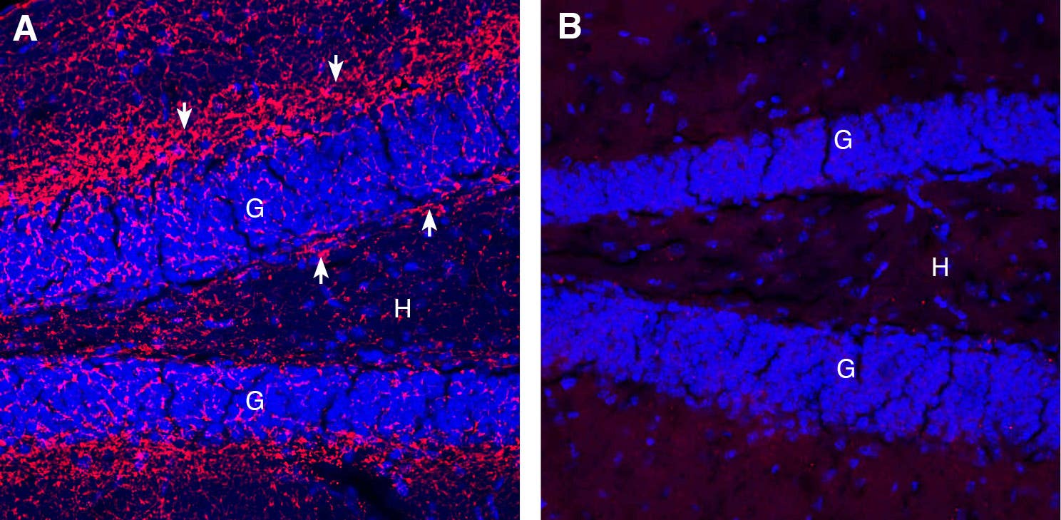 Guinea Pig Anti-Cannabinoid Receptor 1 (extracellular) Antibody