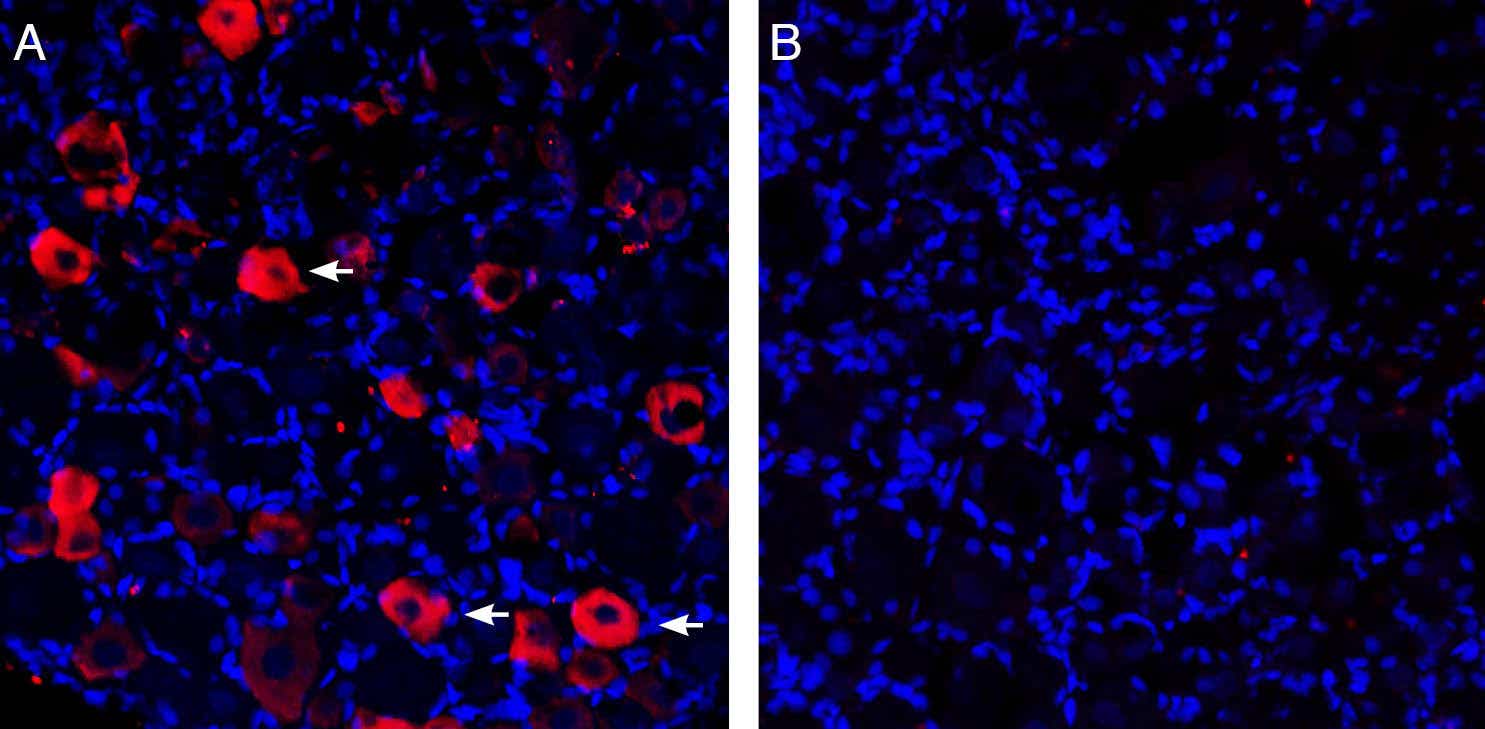 Guinea Pig Anti-P2X3 Antibody