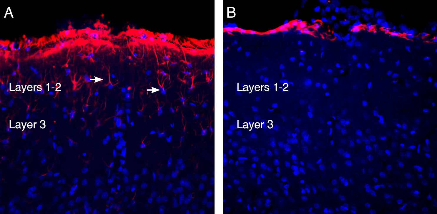 Guinea Pig Anti-GFAP Antibody