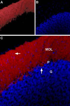 Anti-Glycine Receptor α1 Antibody