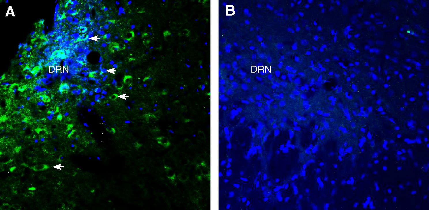 Anti-Glycine Receptor α3 Antibody