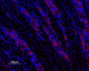 Anti-GALR1 Antibody