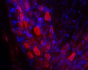 Anti-GALR2 Antibody