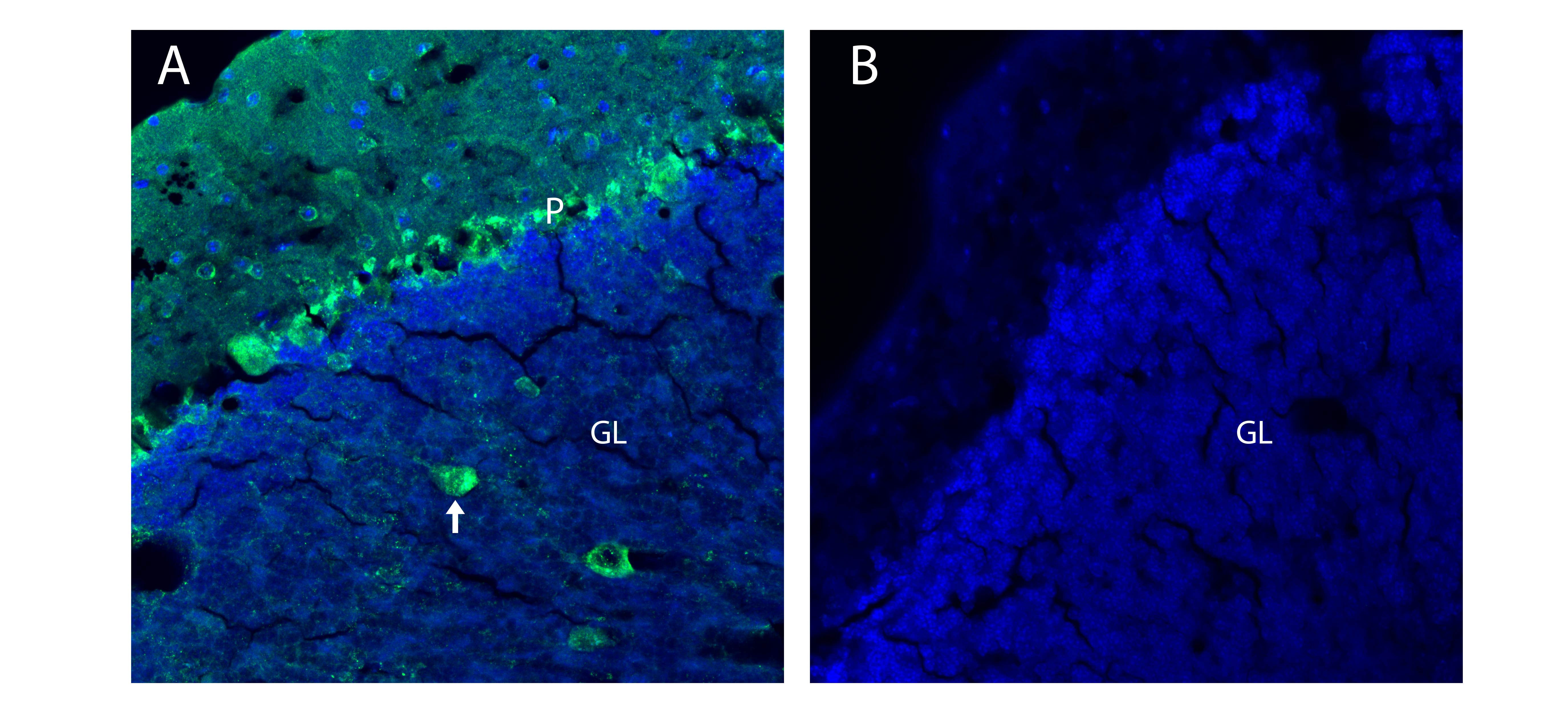 Anti-Glycine Receptor β Antibody