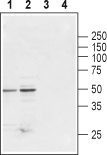 Anti-Glycine Receptor β Antibody - Carrier Free