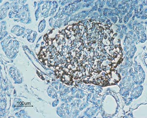 Anti-GLP1R (extracellular) Antibody