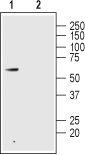 GLP2R (extracellular) Blocking Peptide