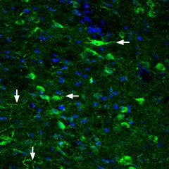 Anti-GLP2R (extracellular) Antibody