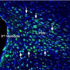 Anti-Glucagon Receptor (extracellular) Antibody