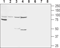 Glucagon Receptor (extracellular) Blocking Peptide