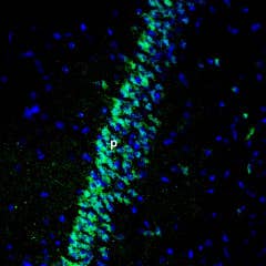 Anti-GIPR (extracellular) Antibody
