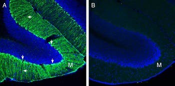 Anti-Secretin Receptor (extracellular) Antibody