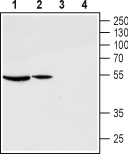 GnRH Receptor (extracellular) Blocking Peptide
