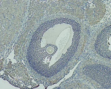Anti-GnRH Receptor (extracellular) Antibody