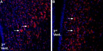 Anti-Ghrelin Receptor (GHSR) (extracellular) Antibody