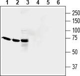 QRFPR/GPR103 (extracellular) Blocking Peptide