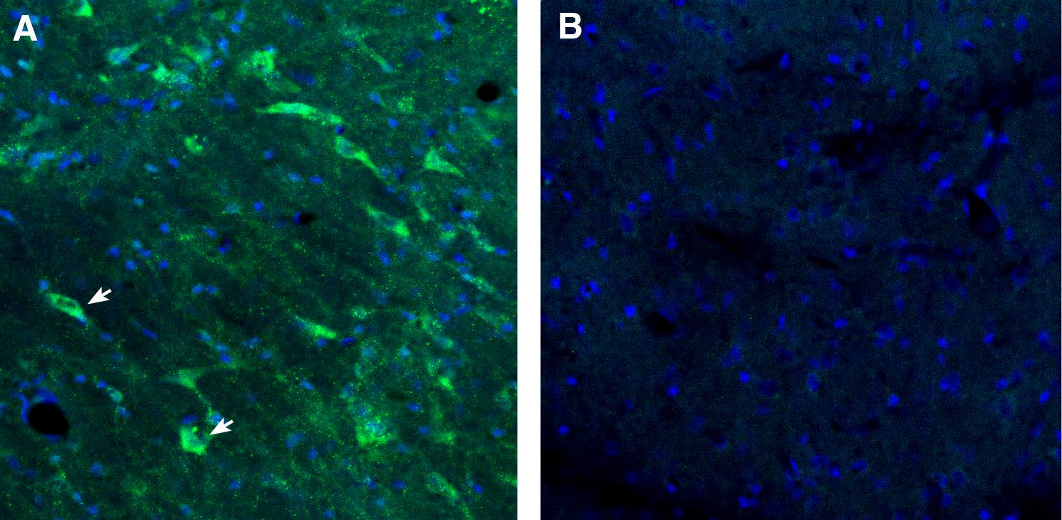 Anti-GPR88 Antibody
