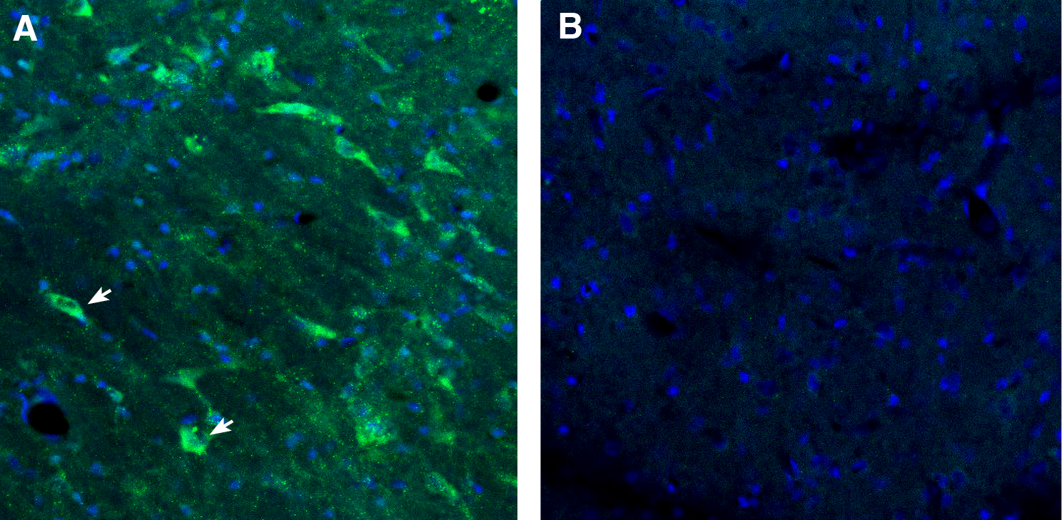 GPR88 Blocking Peptide