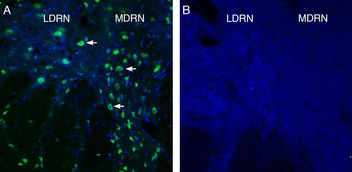 Anti-GPR4 (extracellular) Antibody