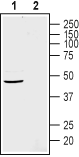 GPR4 (extracellular) Blocking Peptide