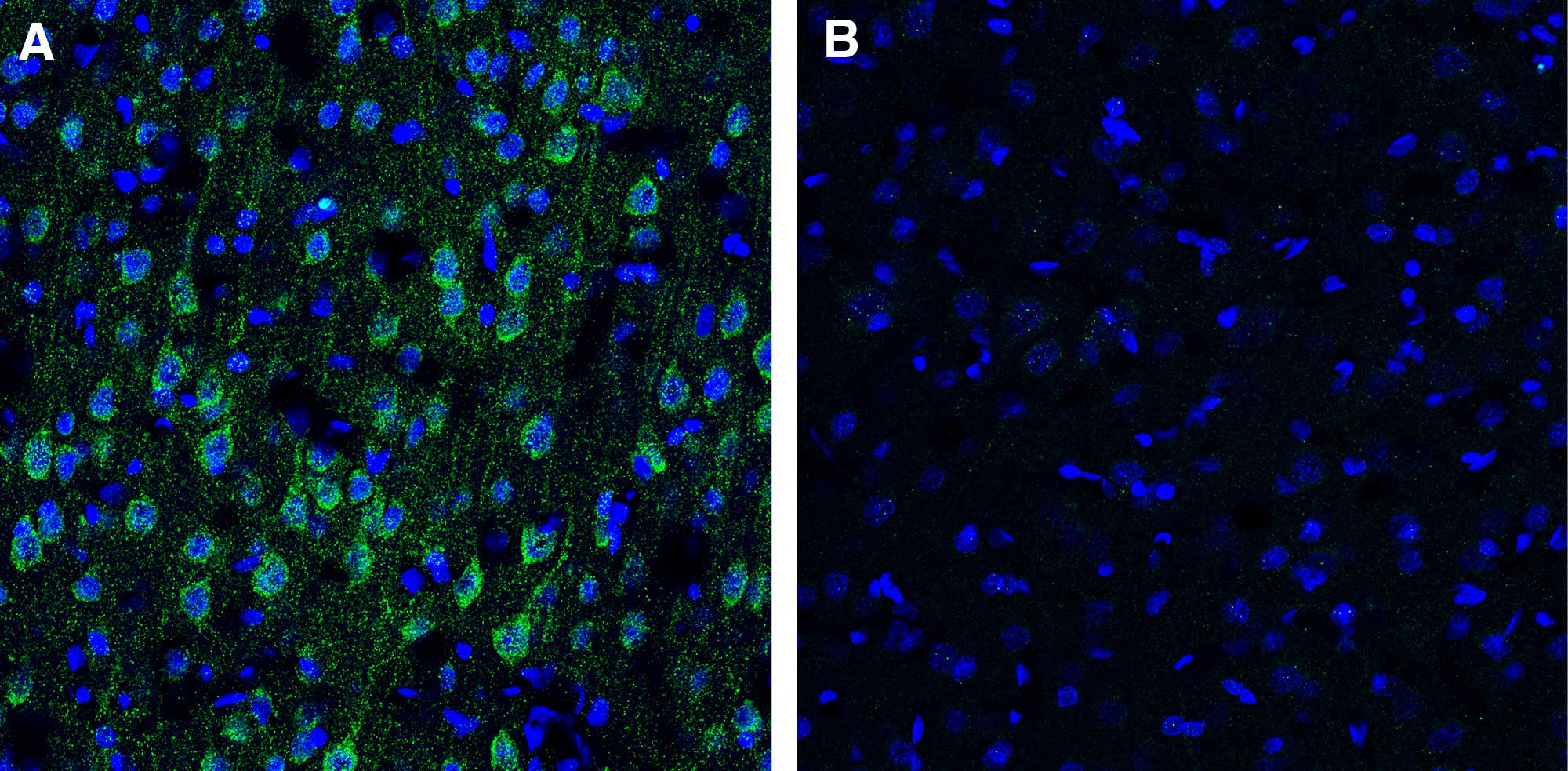 Anti-GPR39 (extracellular) Antibody