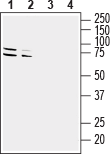 GPR37 (extracellular) Blocking Peptide