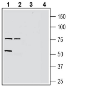 GPR37L1 (extracellular) Blocking Peptide