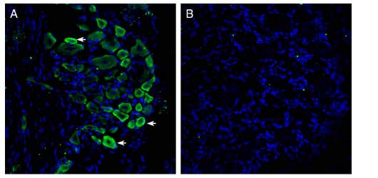 Anti-GPR35 (extracellular) Antibody