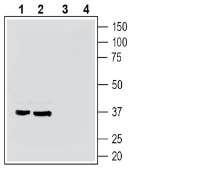 GPR35 (extracellular) Blocking Peptide