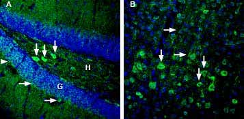 Anti-GPR83 (extracellular) Antibody