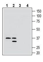 GPR171 (extracellular) Blocking Peptide