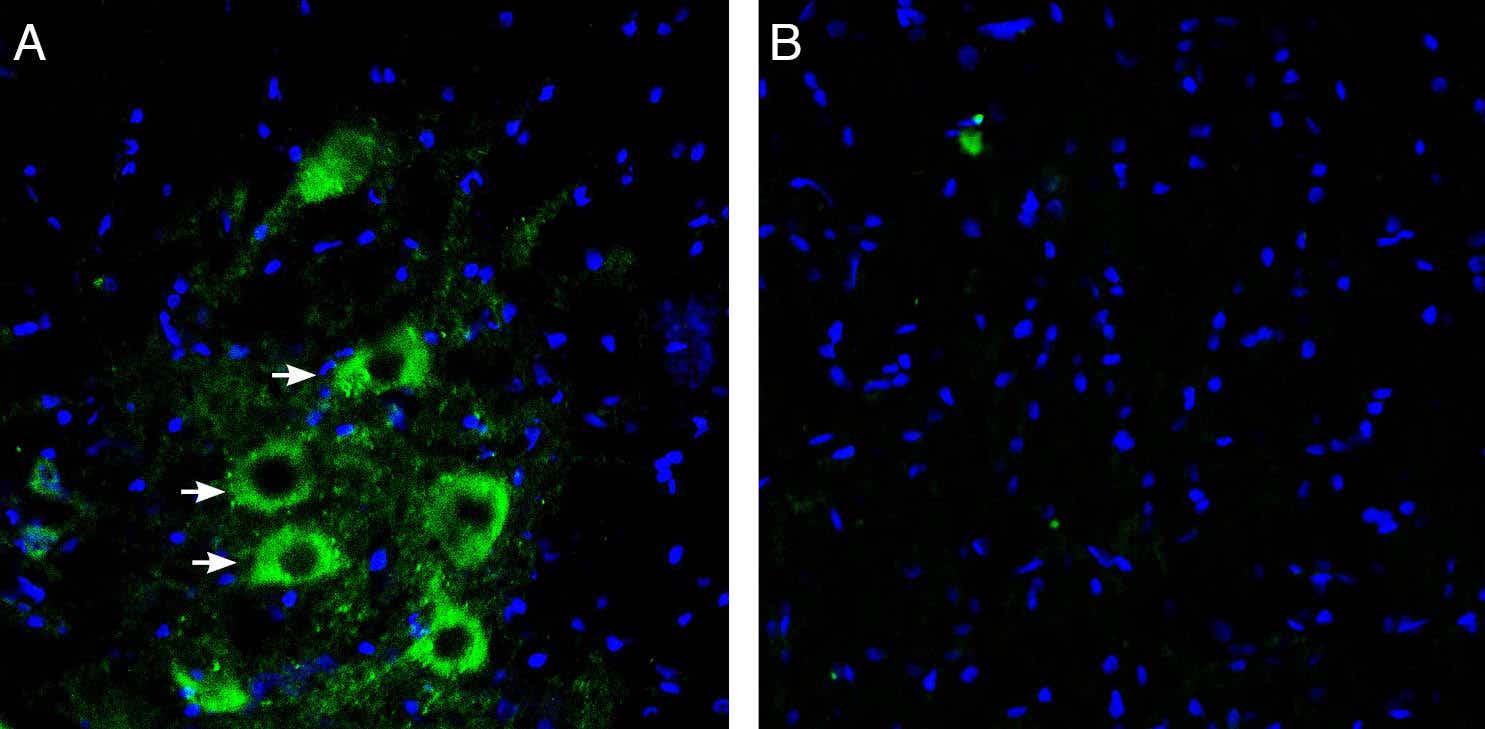 Anti-GPR97 (ADGRG3)(extracellular) Antibody