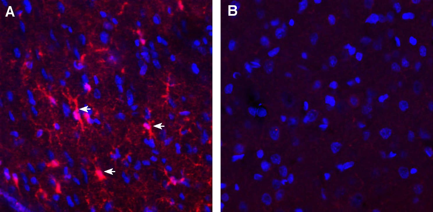 Anti-GPR12 (extracellular) Antibody