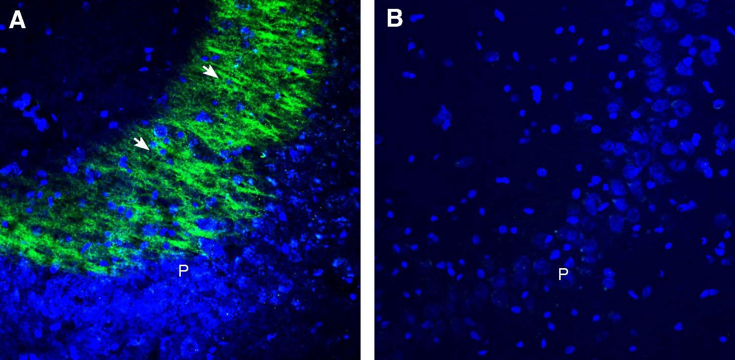 Anti-GPR31 (extracellular) Antibody