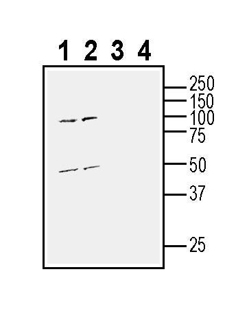 GPR31 (extracellular) Blocking Peptide