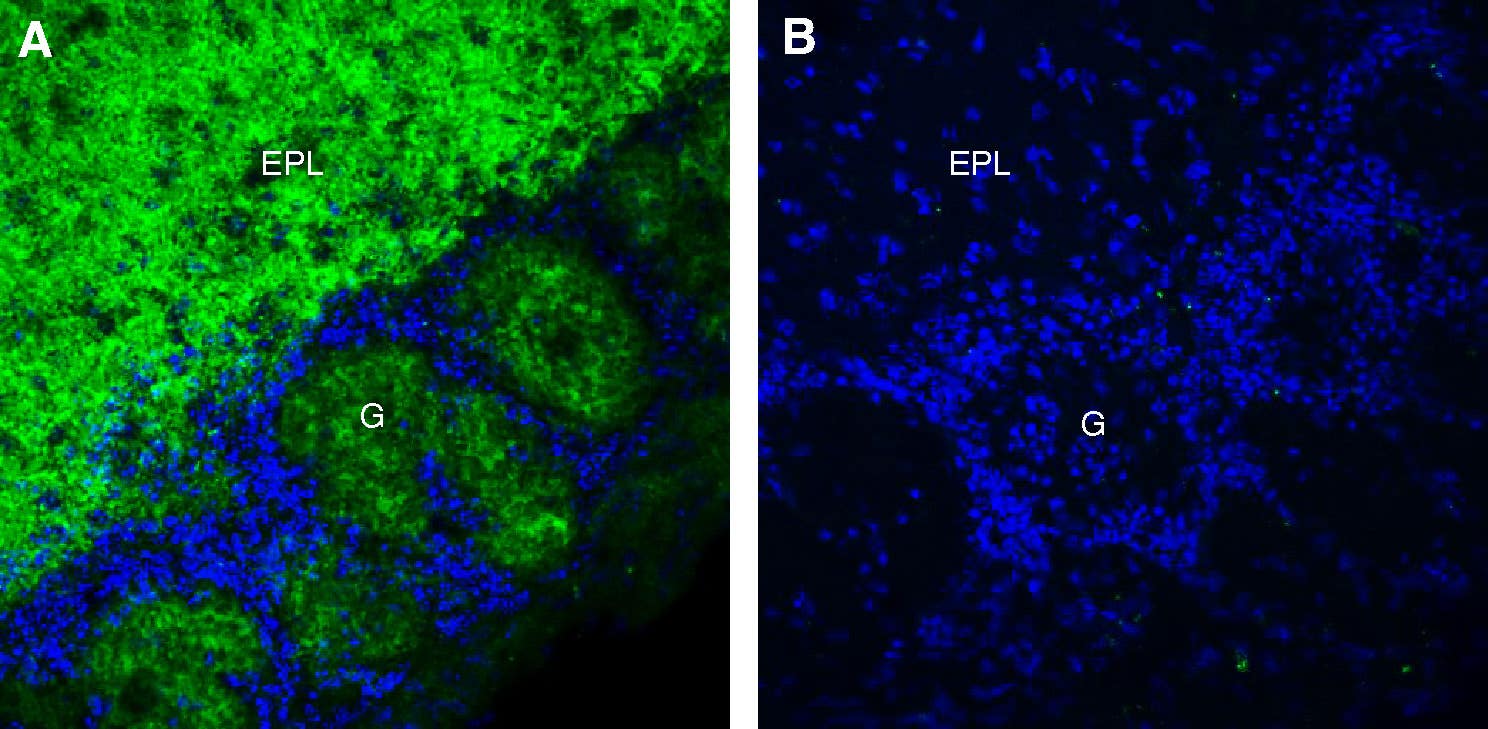 Anti-GPR26 Antibody
